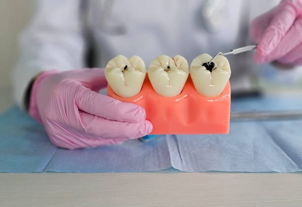 طب الاسنان